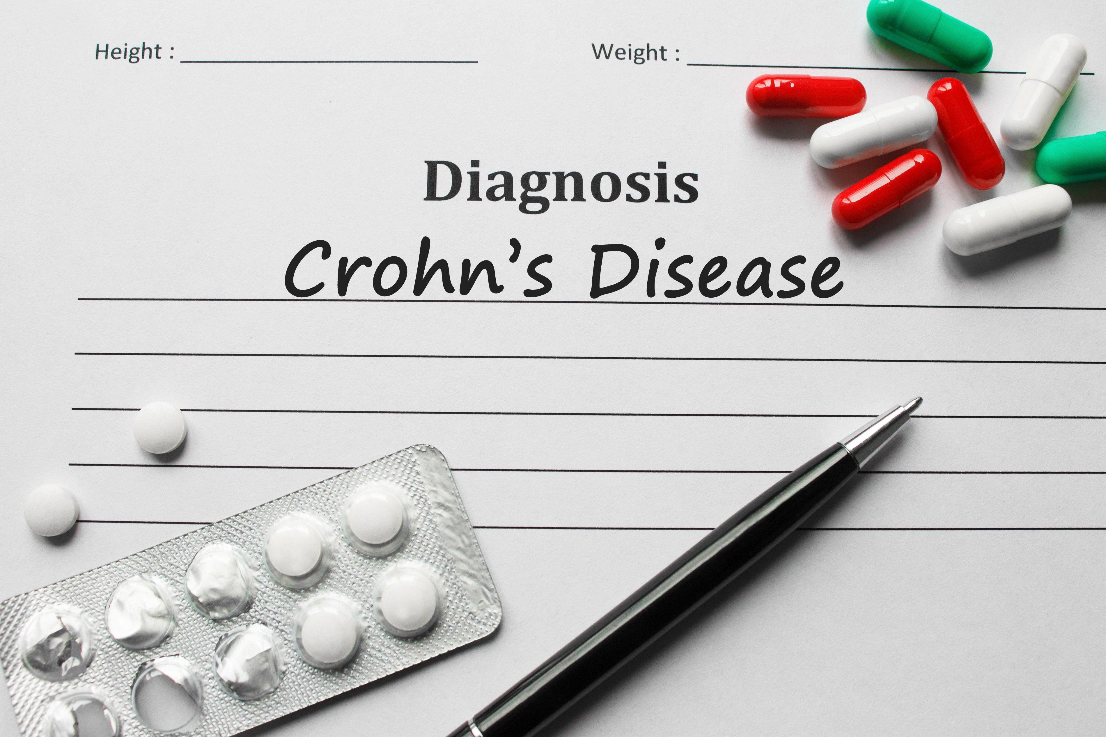 maladie de crohn et douleurs articulaires maladie de crohn et douleurs articulaires